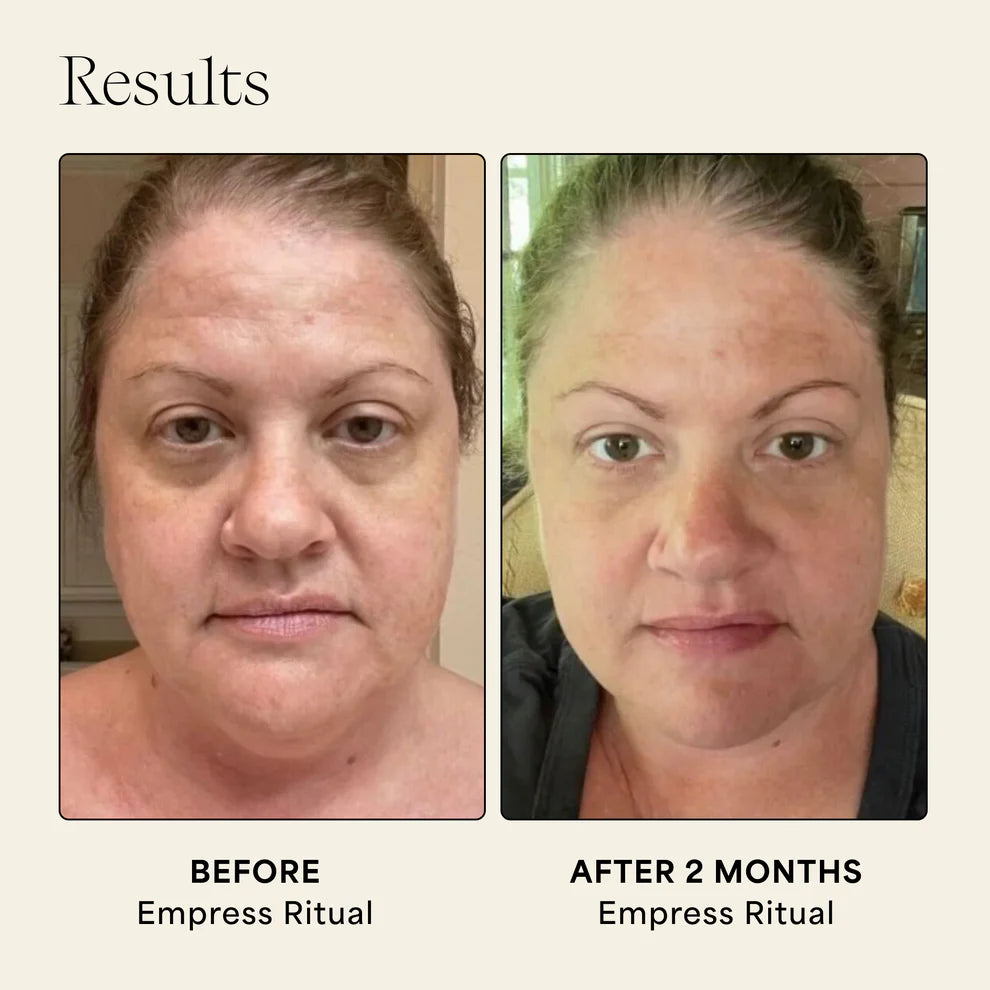 Wildling- Empress Collection