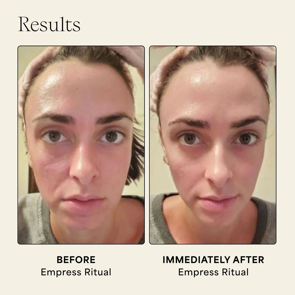 Empress Stone- Award-winning, and patented facial Gua Sha tool